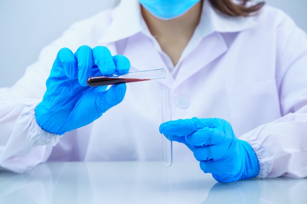 Científico técnico analizando una muestra de sangre en tubo de ensayo en oratorio de laboratorio