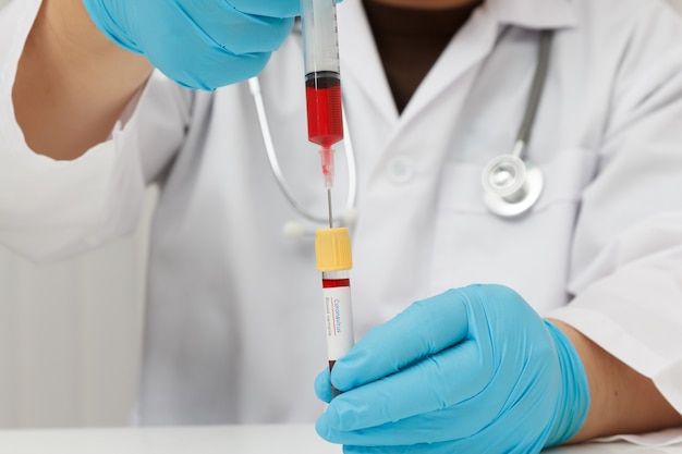 Cientista de laboratório pesquisando vacina cobiçada em laboratório