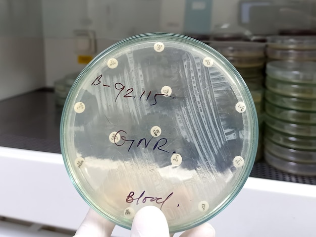 Cientista ou tecnólogo de laboratório segura placa de meio de cultura que está pronta para cultura bacteriana.