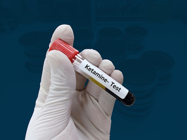 Cientista segura amostra de sangue para teste de cetamina