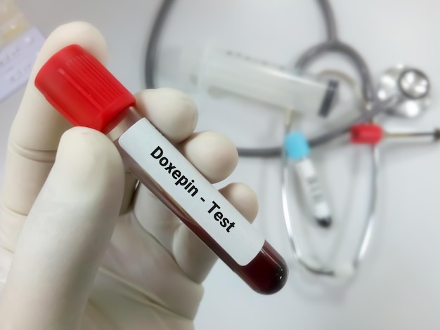 Cientista segura amostra de sangue para teste de nível de doxepina