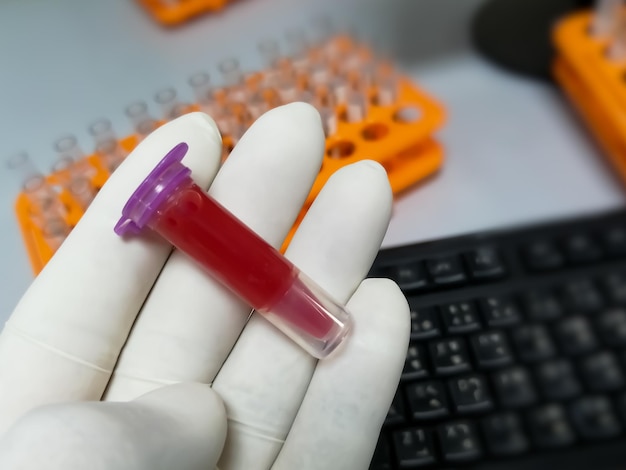 Foto cientista segurando eppendorf com amostra de sangue hemolisada.