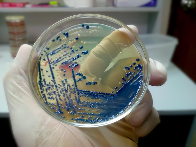 Cientista segurando meios de cultura bacterianos no laboratório de microbiologia