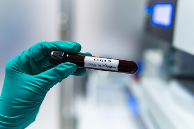 Foto cientista segurando tubo de ensaio com amostra de sangue para teste covid19experiência para detectar vírus foi encontrada no sangue
