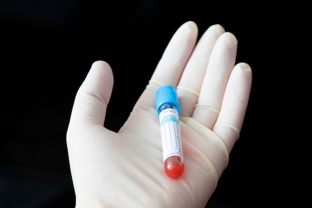 Cientista segurando tubo de ensaio de amostra de sangue em fundo preto closeup com espaço para texto rótulo branco vazio para o nome do paciente ou resultado do exame de sangue Pesquisa de vírus