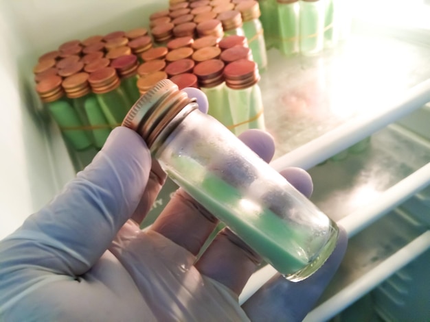 Cientista segurando uma garrafa média sólida de ágar LowensteinJensen. Cultura para Mycobacterium tuberculosis