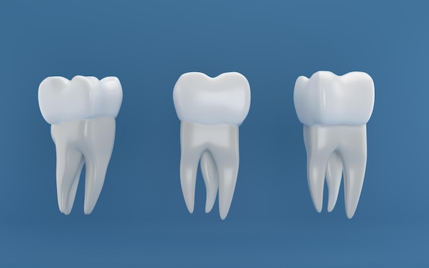 Cirugía de implantes dentales renderizado 3d