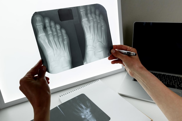 Cirujano ortopédico examinando una radiografía del pie