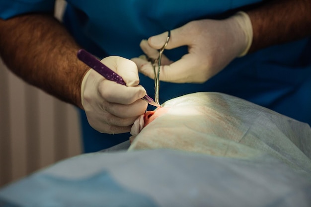 Cirujano poniendo puntos de sutura durante la cirugía plástica cosmética en el quirófano del hospital