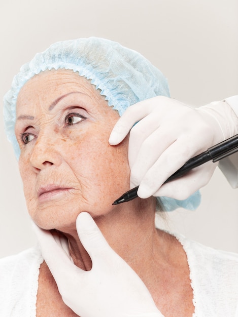 Foto el cirujano realiza un control de la piel en una mujer de mediana edad antes de la cirugía plástica. modelo femenino senior. cirugía plástica, lifting, concepto de envejecimiento