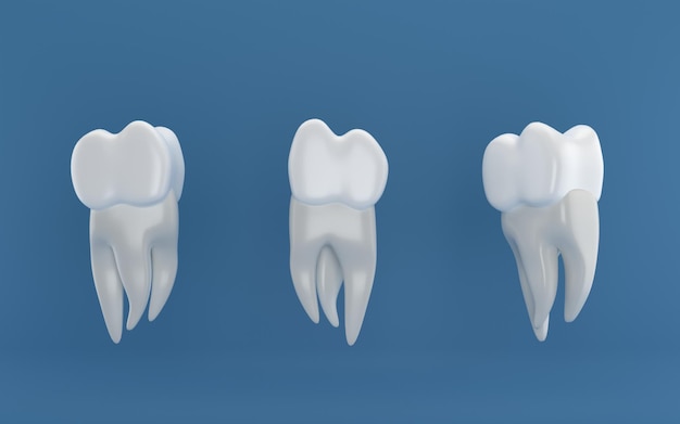 Cirurgia de implantes dentários renderização em 3d