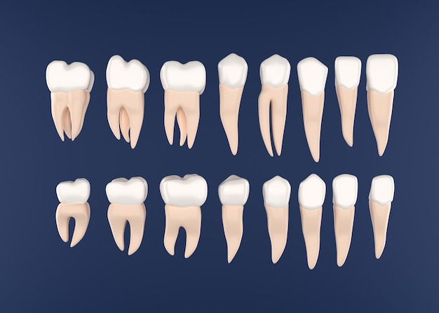 Cirurgia de implantes dentários renderização em 3d