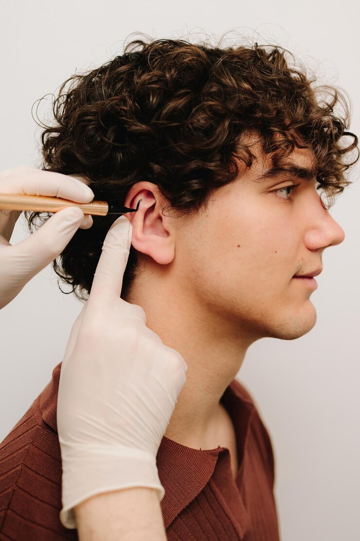 Cirurgião desenhando linhas de marcação antes da otoplastia cirurgião nas orelhas Aplicando marcação na pinha da orelha para corrigir a forma das orelhas Otoplastia marcação na orelha