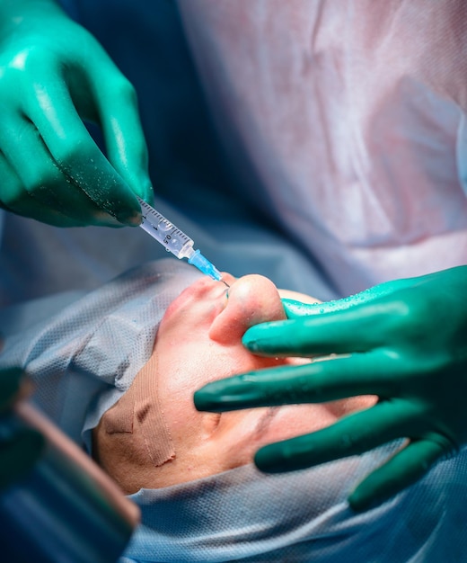 Cirurgião e seu assistente realizando cirurgia plástica no nariz na sala de cirurgia do hospital Remodelagem do nariz Rinoplastia