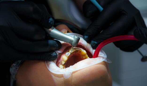 Foto clínica de ortodoncia profesional reparación de dientes dentales de cerca