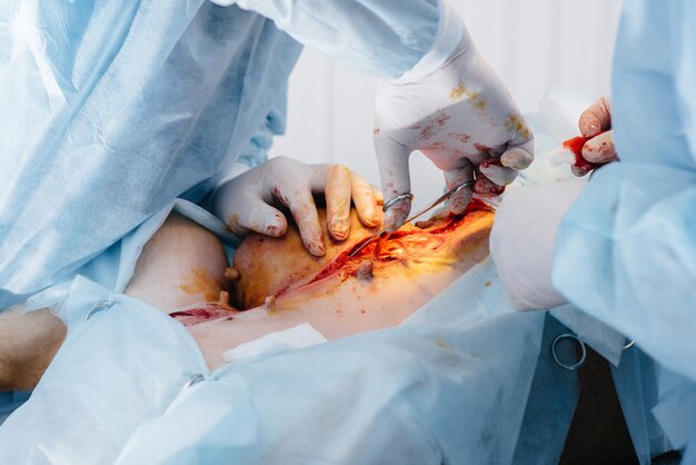 En una clínica veterinaria moderna, se realiza una operación para salvar la vida de un perro grande. Cirugía y medicina.