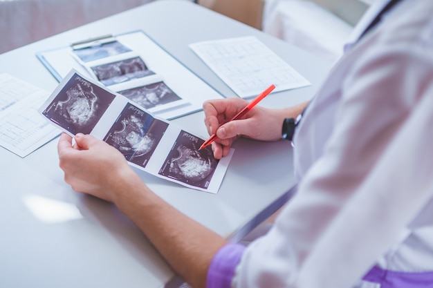 Clínico geral examina imagens de ultra-som do paciente durante uma verificação de saúde e consulta. Cuidados de saúde e medicina. Diagnóstico e tratamento da doença