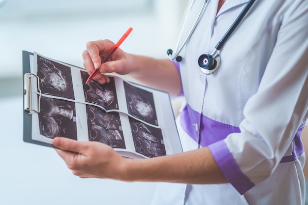 Clínico geral examina imagens de ultra-som do paciente durante uma verificação de saúde e consulta. Cuidados de saúde e medicina