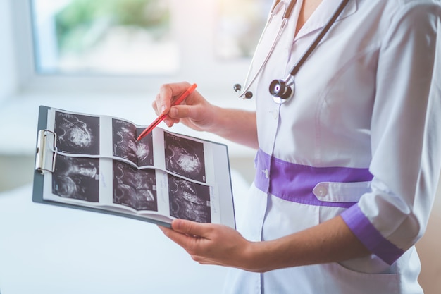 Clínico geral examina imagens de ultra-som do paciente durante uma verificação de saúde e consulta médica. Cuidados de saúde e medicina