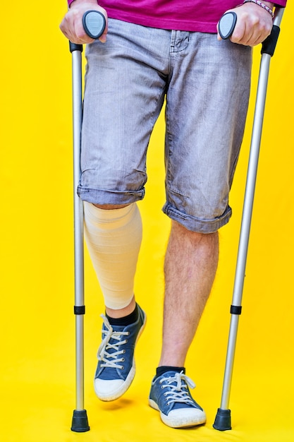 Foto close das pernas de um homem, de frente, com shorts e muletas, com a perna enfaixada.