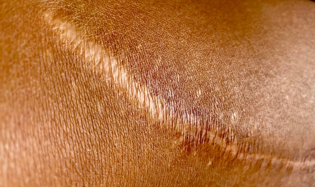 Foto close de um couro dourado com uma cicatriz.