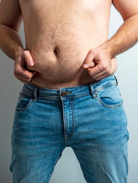 Close de um homem segurando as dobras de sua barriga gorda. O conceito de problemas com o excesso de peso, uma clínica para emagrecer