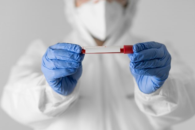 Foto close de um médico segurando uma amostra de sangue