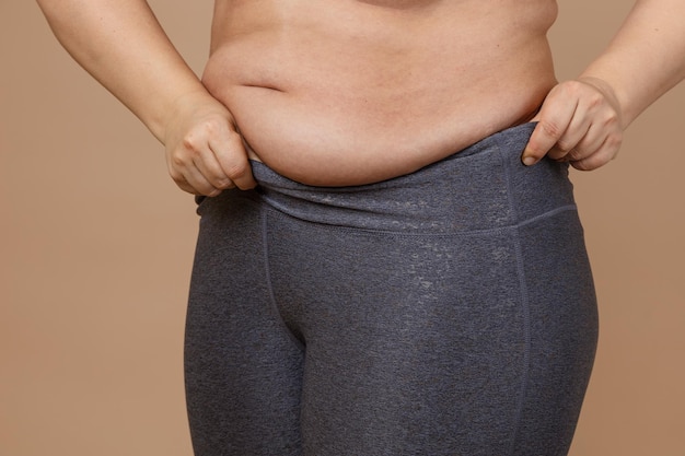 Close de uma mulher adulta gorda com barriga obesa puxando leggings Positivo para o corpo Violação da elasticidade celular Perda de nutrientes Pele flácida após gravidez ou perda de peso repentina