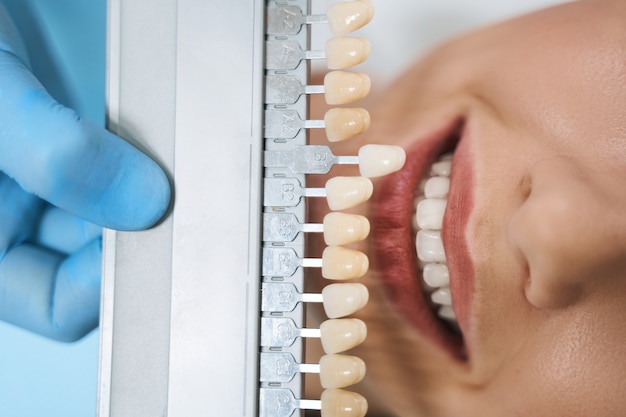 Close de uma mulher alegre em consulta com um dentista para melhorar a saúde bucal e um belo sorriso