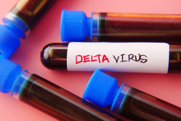 Foto close do tubo de ensaio de sangue com vírus delta corona sobre fundo azul