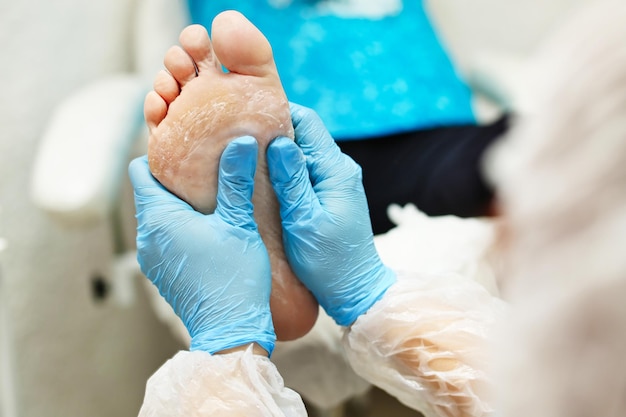 Close-up da mão do terapeuta fazendo massagem nos pés no homem