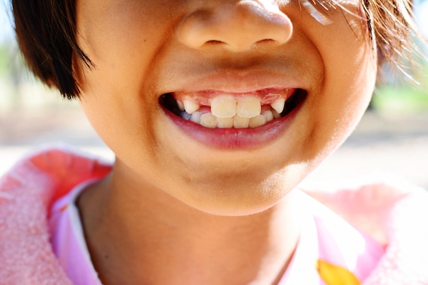 Close-up da parte média de uma menina sorridente mostrando dentes