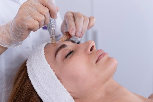 Close-up de cosmetologistaesteticista aplicando tratamento facial dermapen no rosto do cliente jovem no salão de belezaCosmetologia e rejuvenescimento profissional do rosto de cuidados com a pele