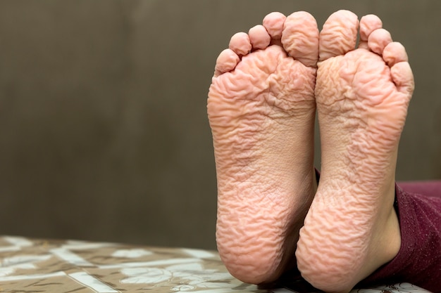 Close-up de crianças pés enrugados após banho longo