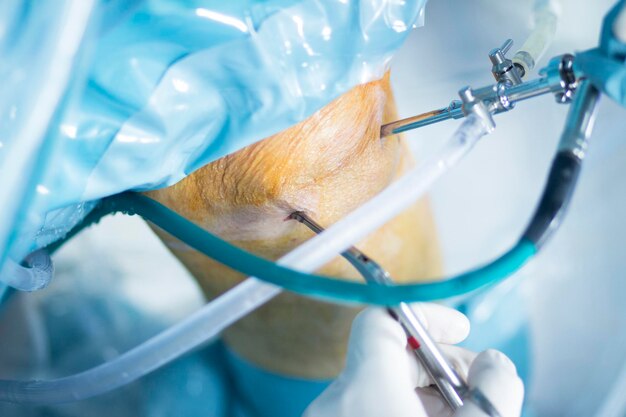 Foto close-up de equipamento médico em joelho ferido na sala de cirurgia