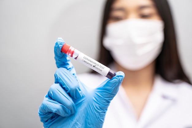 Foto close-up de médico asiático segurando uma amostra de sangue do tubo de ensaio de coronavírus vestindo jaleco, máscara branca e luvas azuis de nitrilo para proteção contra infecção por vírus contagioso