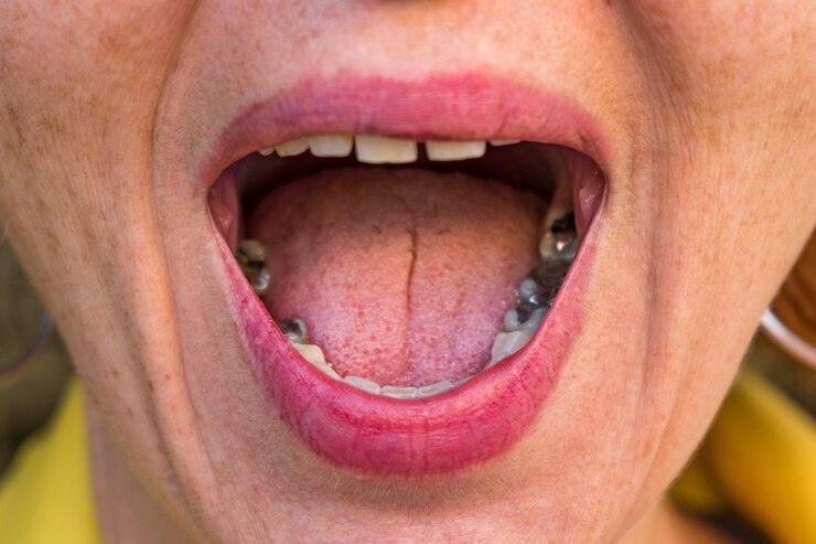 Foto close-up de mulher com a boca aberta