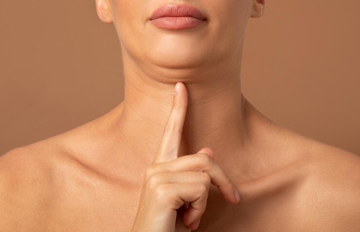 Foto close-up de mulher mostrando problemas de segundo queixo com excesso de peso demonstrando seu problema cosmético