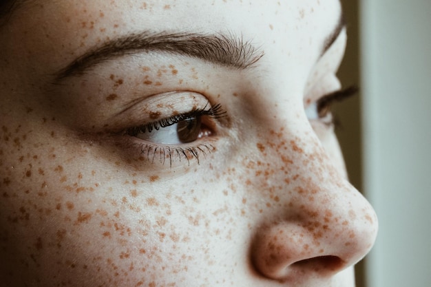 Close-up de mulher pensativa com sardas no rosto