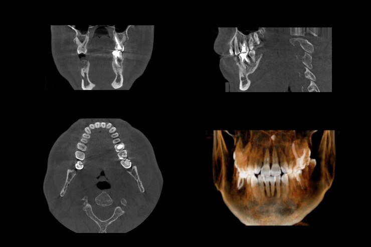 Foto close-up de raios-x médicos contra fundo preto