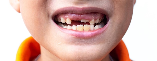 Close-up de um menino com dentes espaçados em casa