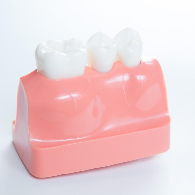 Close up de um modelo de implante dentário