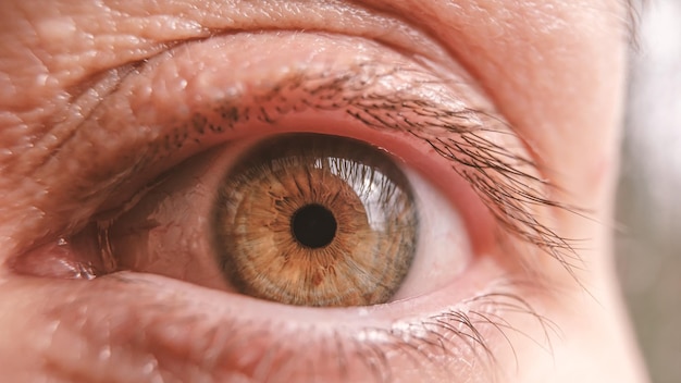 Close-up de um olho feminino cansado vermelho sem maquiagem à luz do dia natural