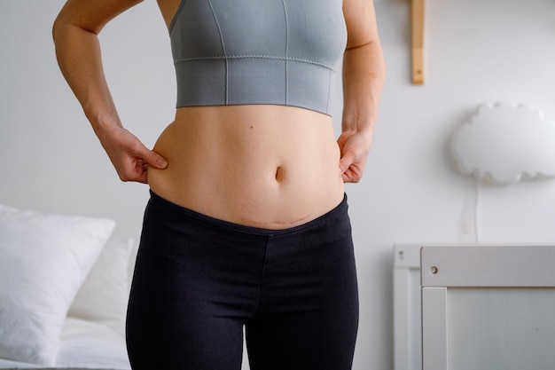 Close-up de uma barriga com cicatriz de cesárea e gordura lateral da barriga Saúde da mulher Uma mulher vestida com roupas esportivas demonstrando seu corpo imperfeito após um parto com berçário ao fundo