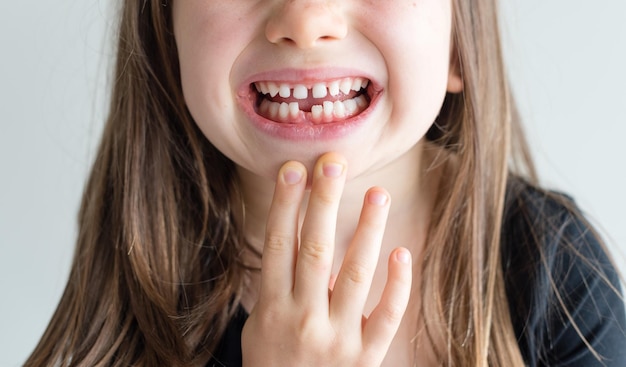 Close-up de uma jovem feliz com um dente perdido