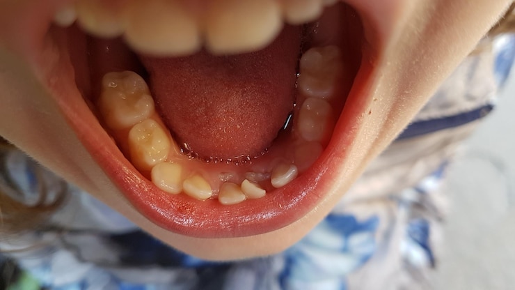 Foto close-up de uma rapariga a abrir a boca