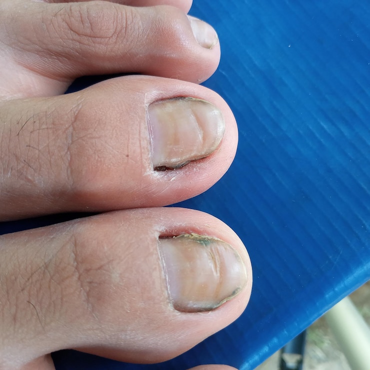 Foto close-up de unhas de dedos de pés humanos