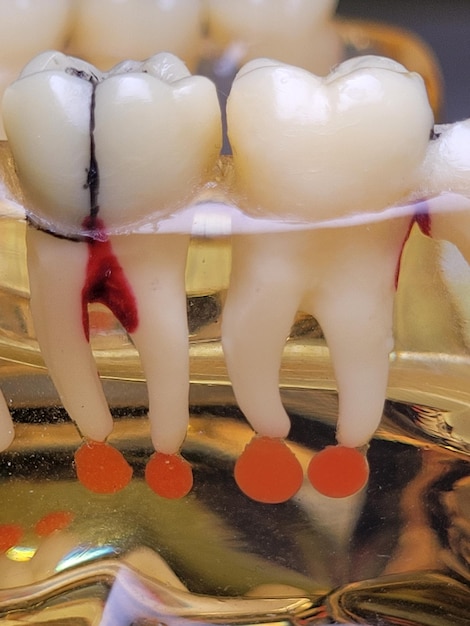 Foto close-up do modelo de tratamento dentário da mandíbula conceitos de estomatologia odontológica