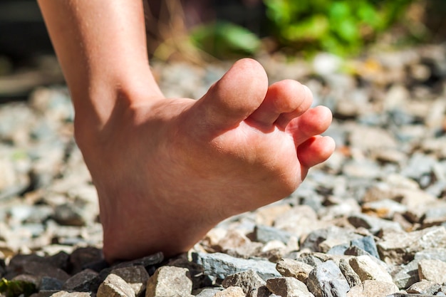Close-up do pé descalço andando sobre pedras, atividade ao ar livre