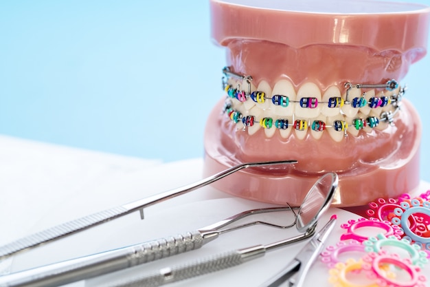 Close up herramientas de dentista y modelo ortodóntico.